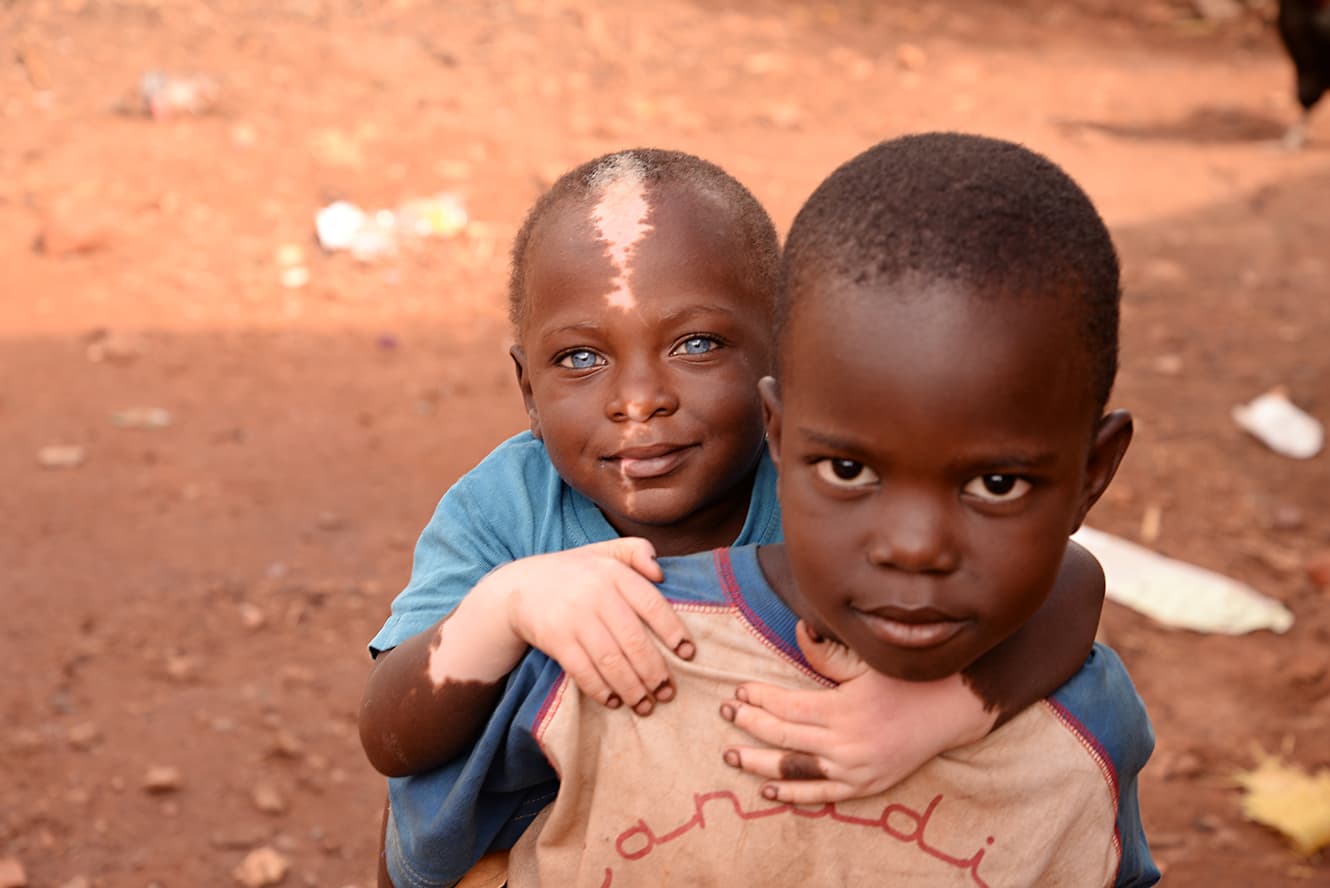 The blue eyed baby no longer abandoned