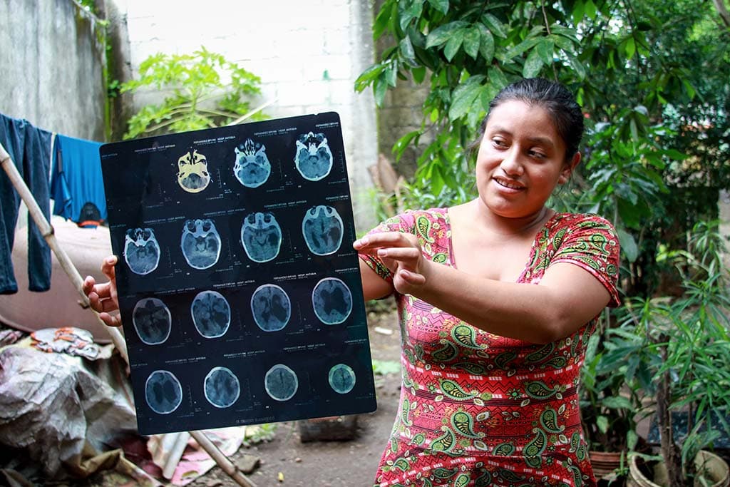 how Zika changed Bryan's life forever