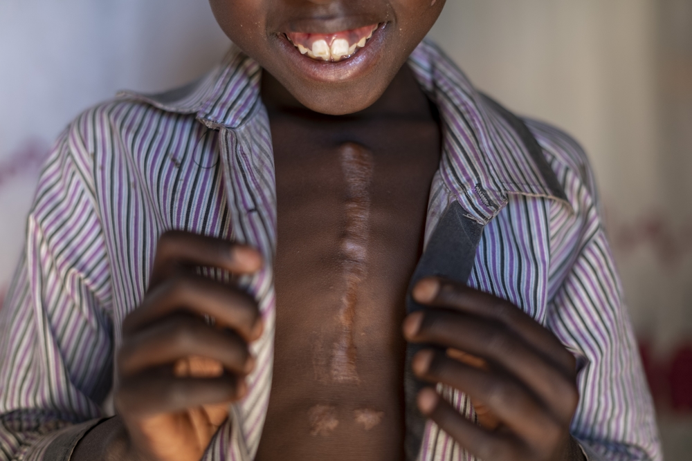 Heart surgery for a child in Uganda